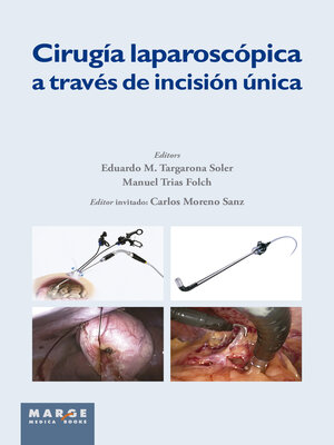 cover image of Cirugía laparoscópica a través de incisión única